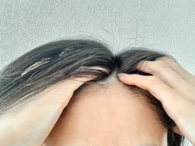 【30代女性】前髪の生え際に使ってみた！使用感をレビュー